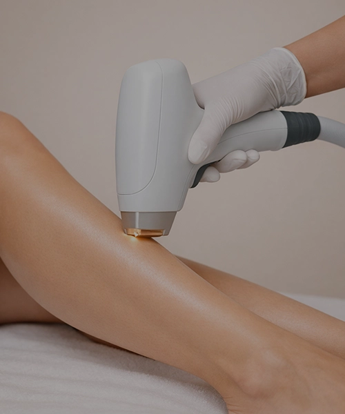 Лазерная эпиляция