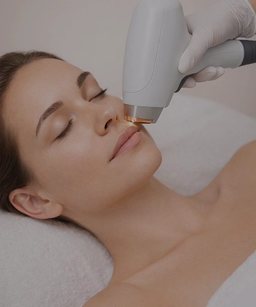 Лазерная эпиляция