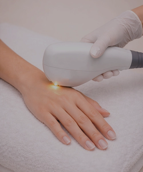 Фотоомоложение